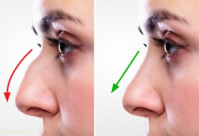 7 Different Nose Shapes and How They Can Be Improved with Rhinoplasty