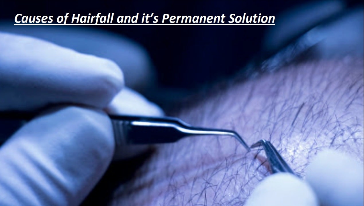 Causes-of-Hairfall-and-its-Permanent-Solution