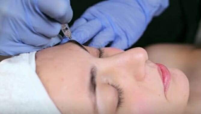 What to Do in Case of a Botched Botox Job